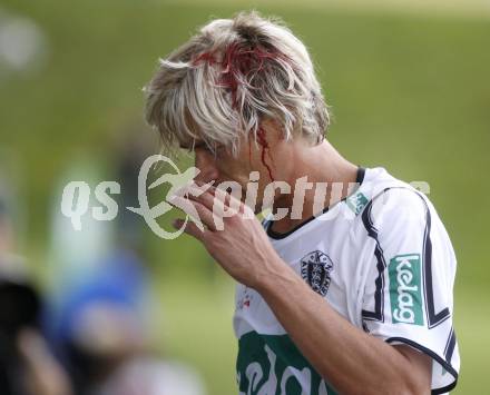 Fussball Testspiel. SK Austria Kaernten gegen Steaua Bukarest. Gerhard Breitenberger mit Cut nach Zusammenstoss (Kaernten), (Bukarest). Feldkirchen, am 2.7.2008.
Copyright: Kuess


---
pressefotos, pressefotografie, kuess, qs, qspictures, sport, bild, bilder, bilddatenbank
